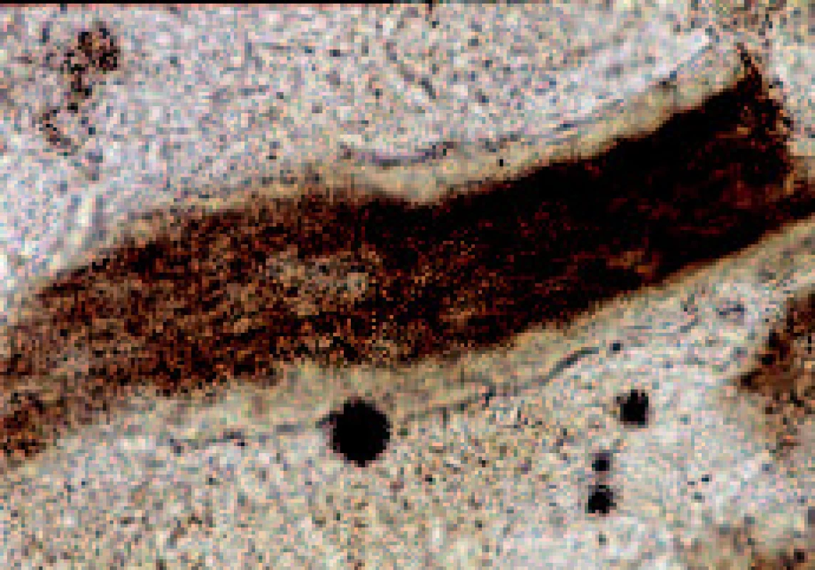 Mikroskopický obraz mikrosporie vlasu.