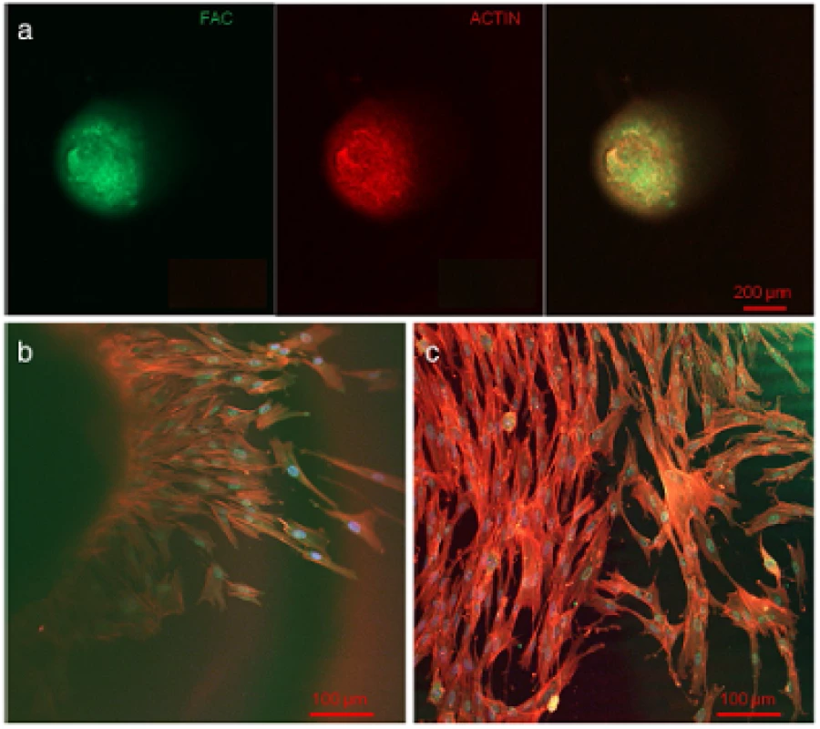 Confocal laser scanning microscopic evaluation. Actin (red), FAC (green) and DAPI (blue) stained cells in the upper third of a pulp sphere (a) and of its outgrown cells (b and c) representing a dense actin formation and consistent round cell nuclei.