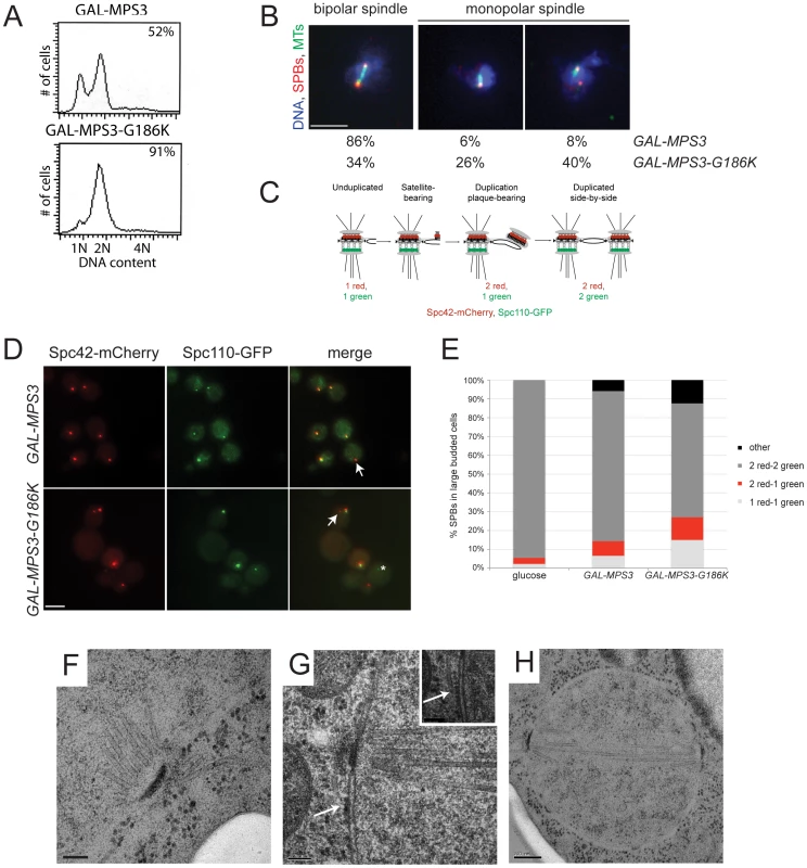 <i>MPS3-G186K</i> expression causes a mitotic arrest due to SPB duplication defects.