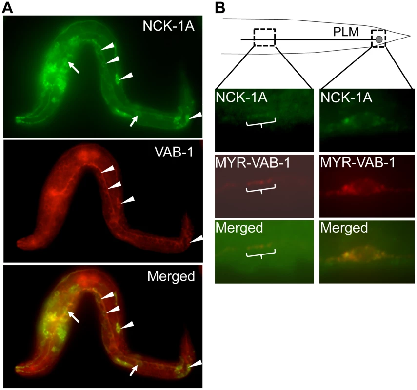 NCK-1 co-localizes with VAB-1.