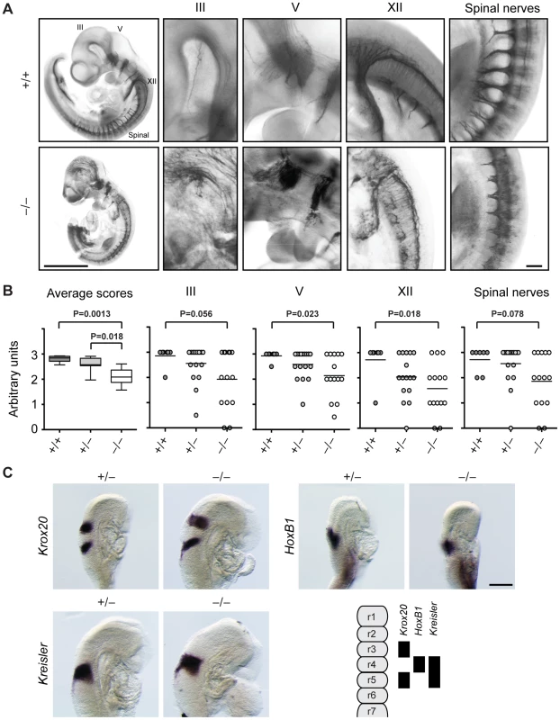 Cranial and spinal nerves are disorganized in Jarid1b knockout embryos.
