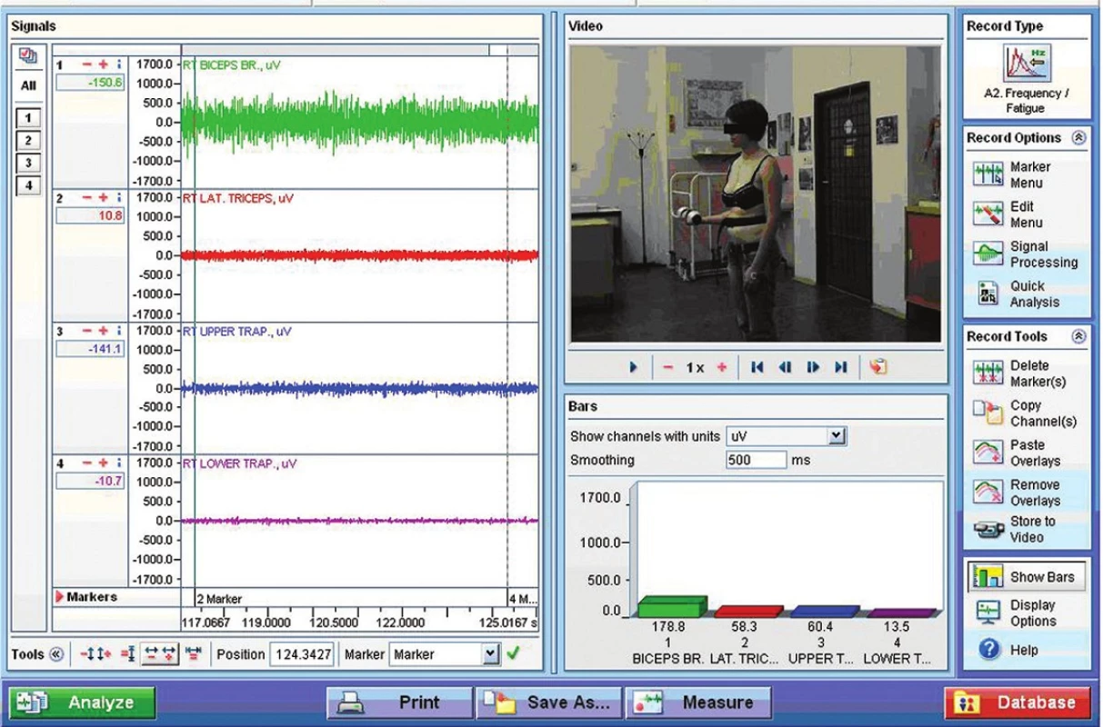 Ukázka EMG záznamu a pozice probanda při provedeném měření s činkou při vypnutém vibračním modu.