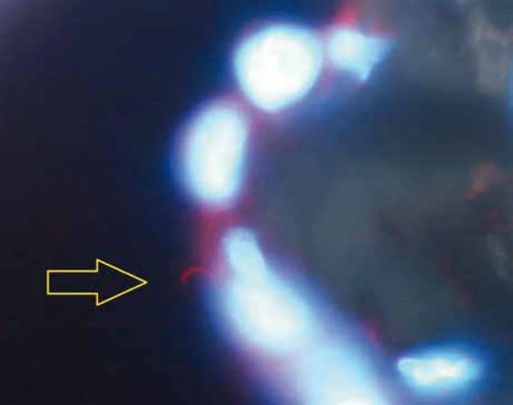 Primární řasinka barvená červeně značenou protilátkou proti acetylovanemu α tubulinu na povrchu buňky mezotelu viscerálního epitelu epikardu srdce (označena žlutou šipkou). Jádra buněk barvená modře (DAPI). Zvětšení 1 000krát.
