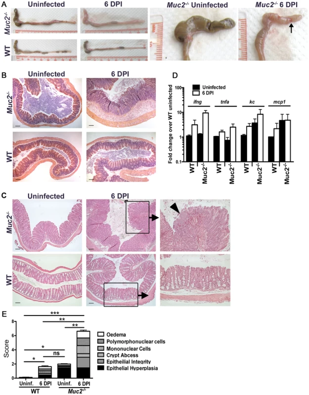 Heightened mucosal damage in <i>Muc2<sup>−/−</sup></i> mice is associated with increased pathogen burdens and mucosa-associated bacterial overgrowths.