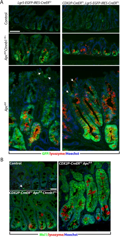 Inactivation of a <i>Ctnnb1</i> allele in <i>Apc</i>-mutant mouse colon epithelium reduces aberrant expansion of the presumptive stem cell pool expressing Msi1 or Lgr5.