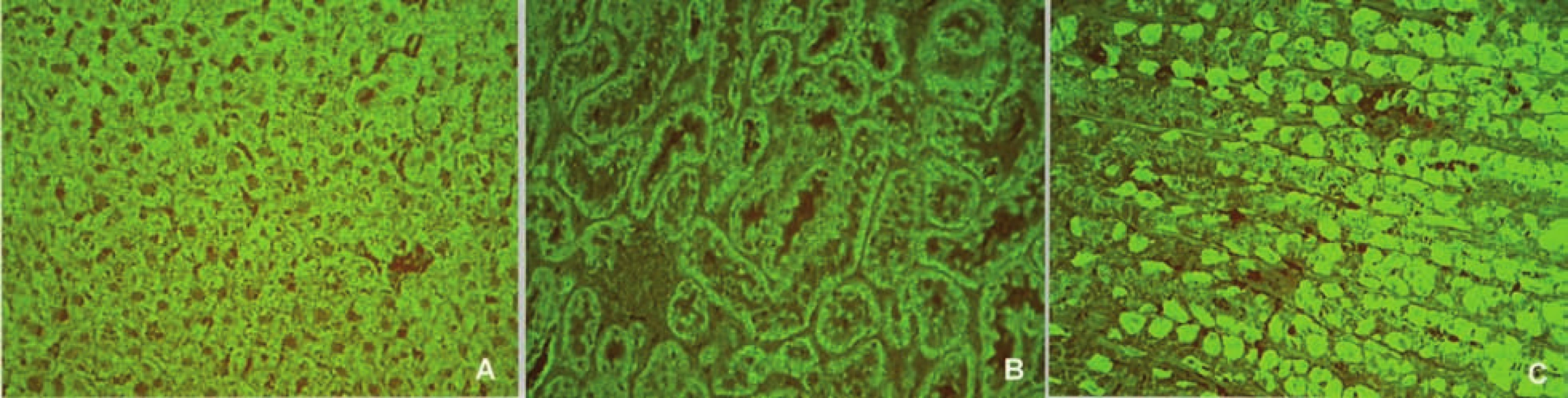 Imunofluorescenční obraz antimitochondriálních protilátek (substrát – krysí játra, ledvina a žaludek, A – jaterní buňky, B – proximální a distální tubuly, C – parietální buňky žaludeční sliznice).
Fig. 6. Immunofluorescent image of anti-mitochondrial antibodies (substrate – rat liver, kidney and stomach, A – liver cells, B – proximal and distal tubules, C – parietal cells of stomach mucosa).