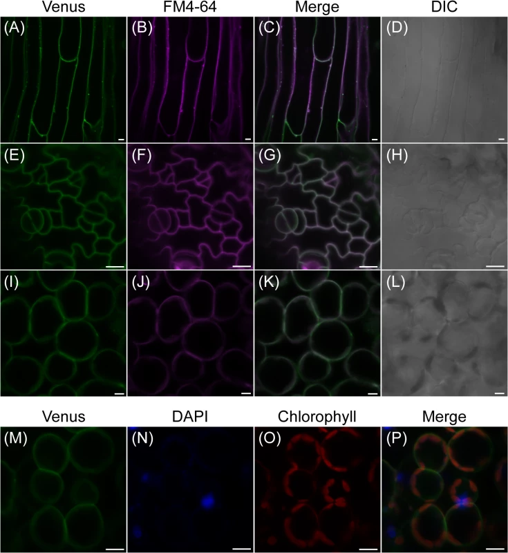 Subcellular localization of fluorescent AtPLC2-Venus in 12-day-old seedlings of <i>ProPLC2</i>:<i>PLC2-Venus</i> transgenic plants.