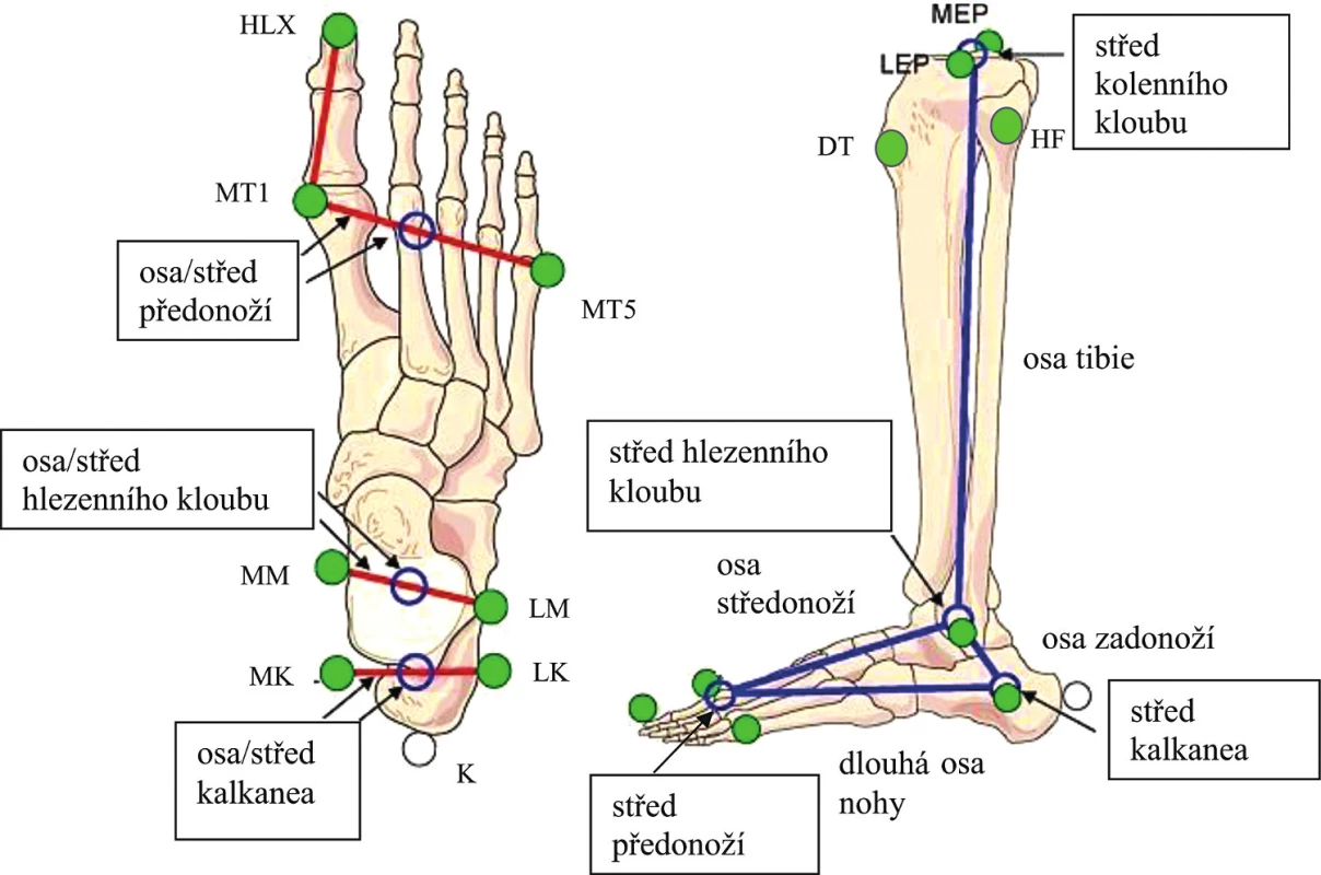 Upravený „multi-segmentální“ model nohy pro 3D kinematickou analýzu (Wolf et al., 2008). 