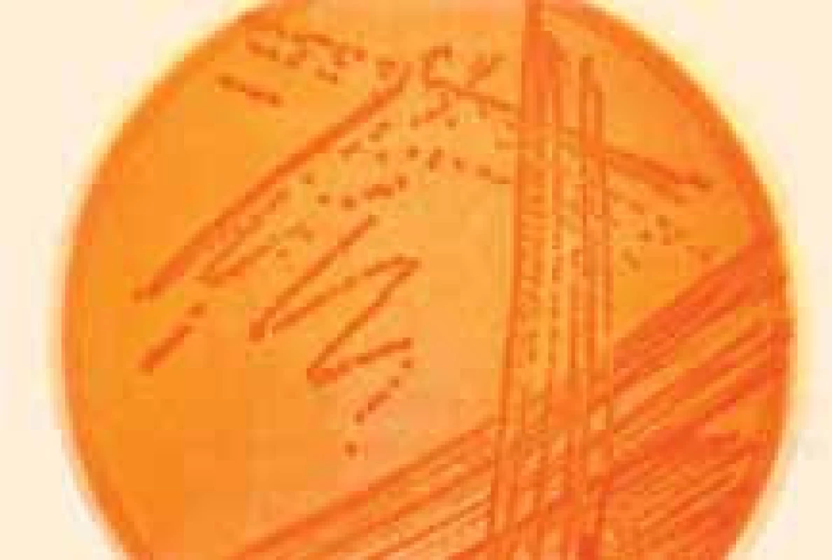 Kultivační medium s E. coli.