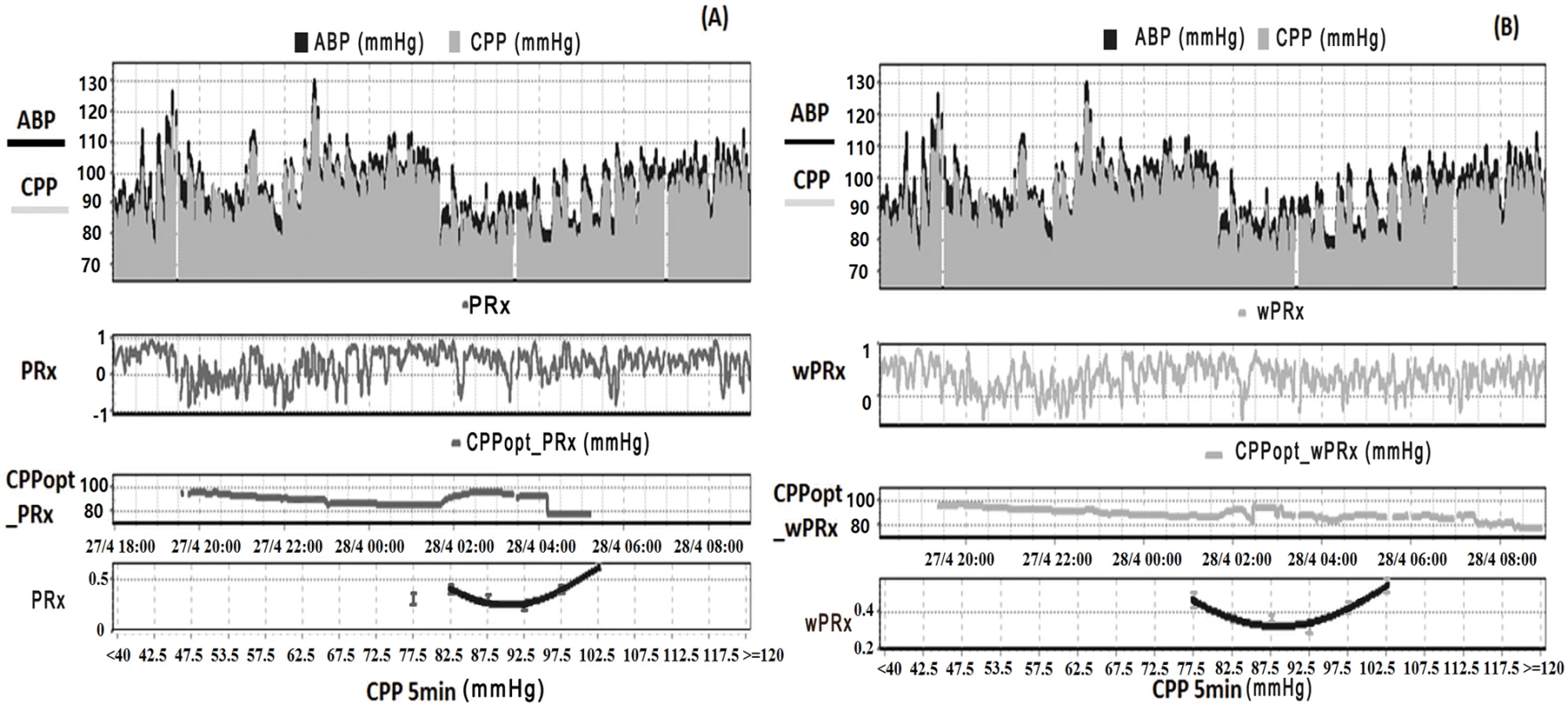 Example of data analysis using ICM+, showing time trends of arterial blood pressure (ABP), cerebral perfusion pressure (CPP), cerebral autoregulation (CA), and optimal CPP (CPPopt).