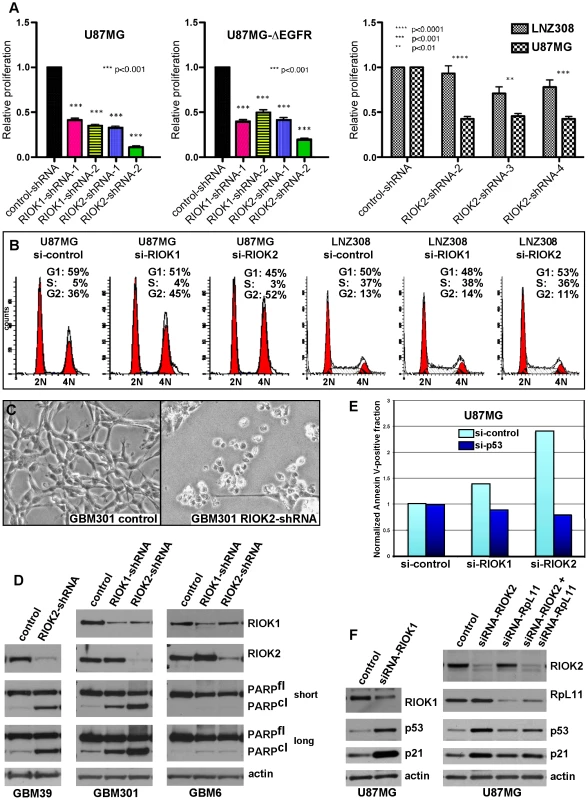 RIOKs drive proliferation and survival of GBM cells in a p53-dependent manner.