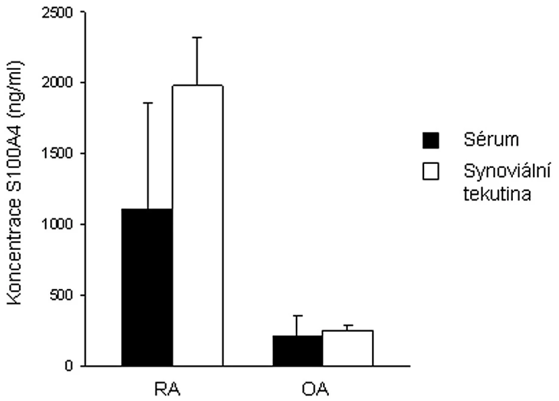 Srovnání hladin S100A4 proteinu v plazmě a synoviální tekutině pacientů s revmatoidní artritidou a osteoartrózou.