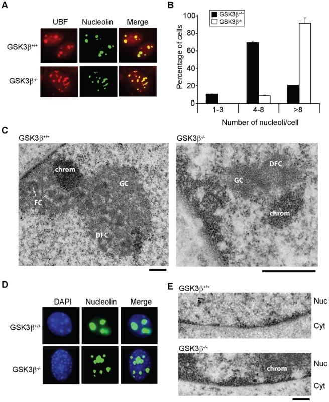 The effects of GSK3β knockout on the morphology of the nucleolus.