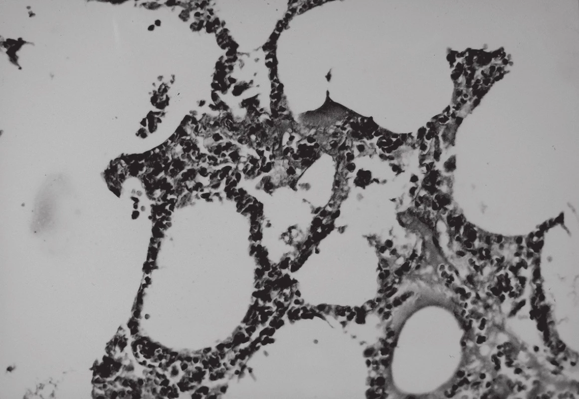 Mikroskopický obraz pľúcneho tkaniva počas pôsobenia vákua; HE, 250x.