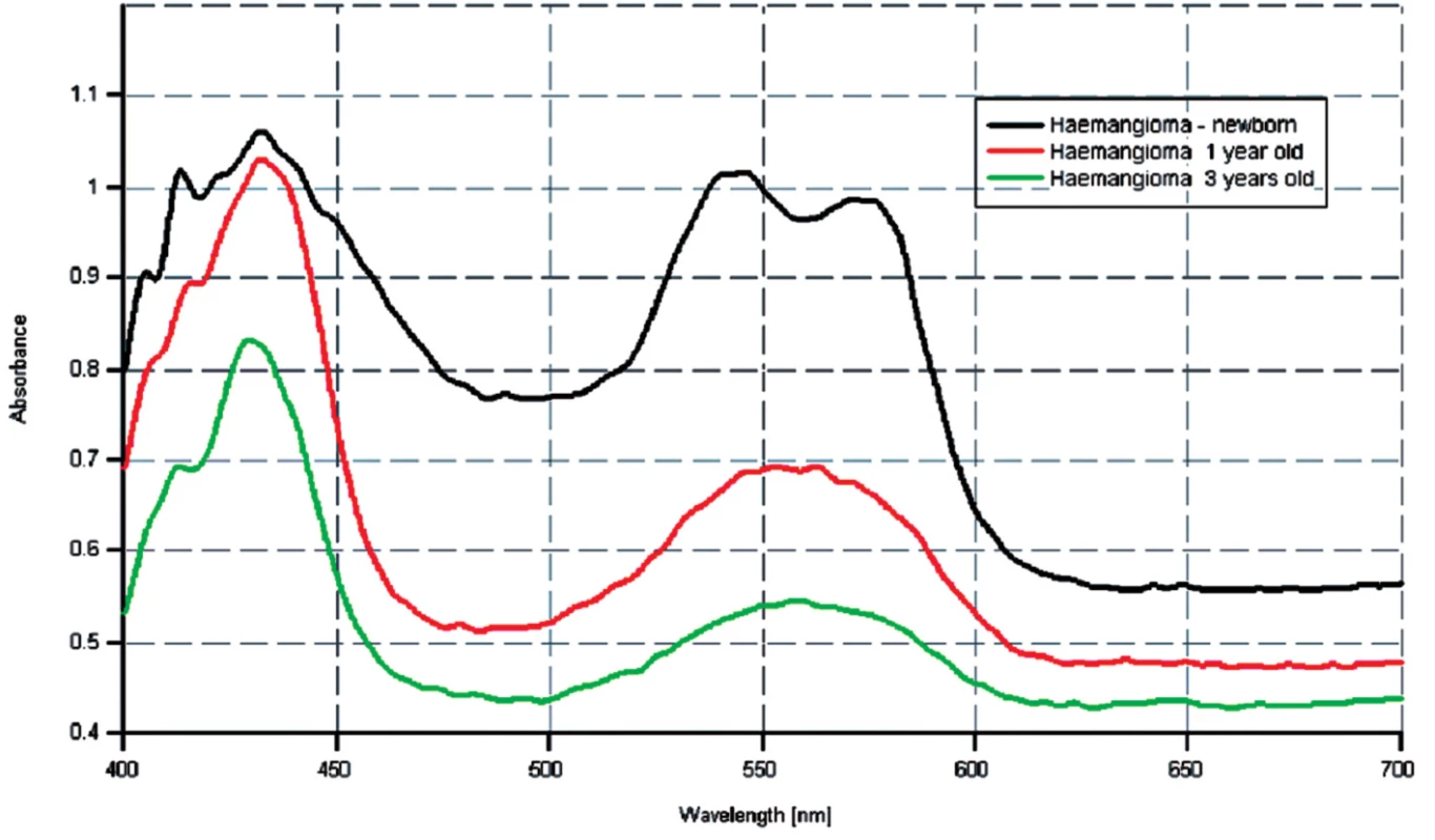 Spektrálne krivky u pacienta s hemangiómom v regresii.