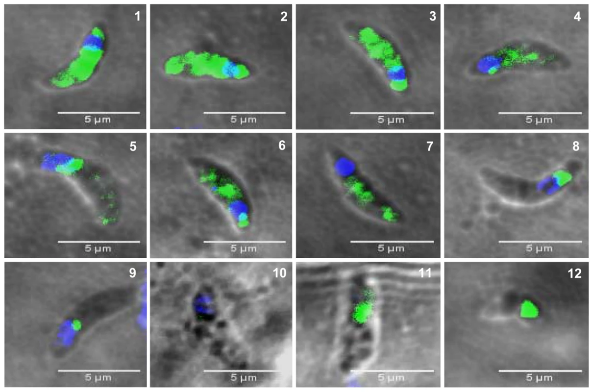The presence of TgNF3 in the cytoplasm of dormant bradyzoites is accompanied by profound changes in parasite's nucleus.