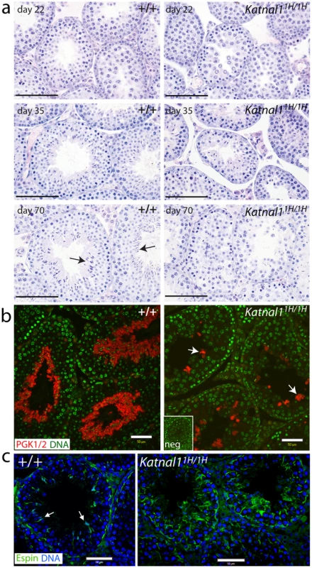 Histological analysis of testis sections reveals disruption to the seminiferous epithelium associated with a reduction in numbers of post-meiotic germ cells.