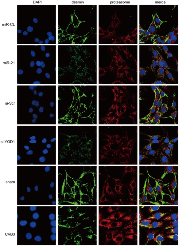 miR-21, YOD1 siRNA or CVB3 infection induces co-localization of desmin proteins and proteasomes.
