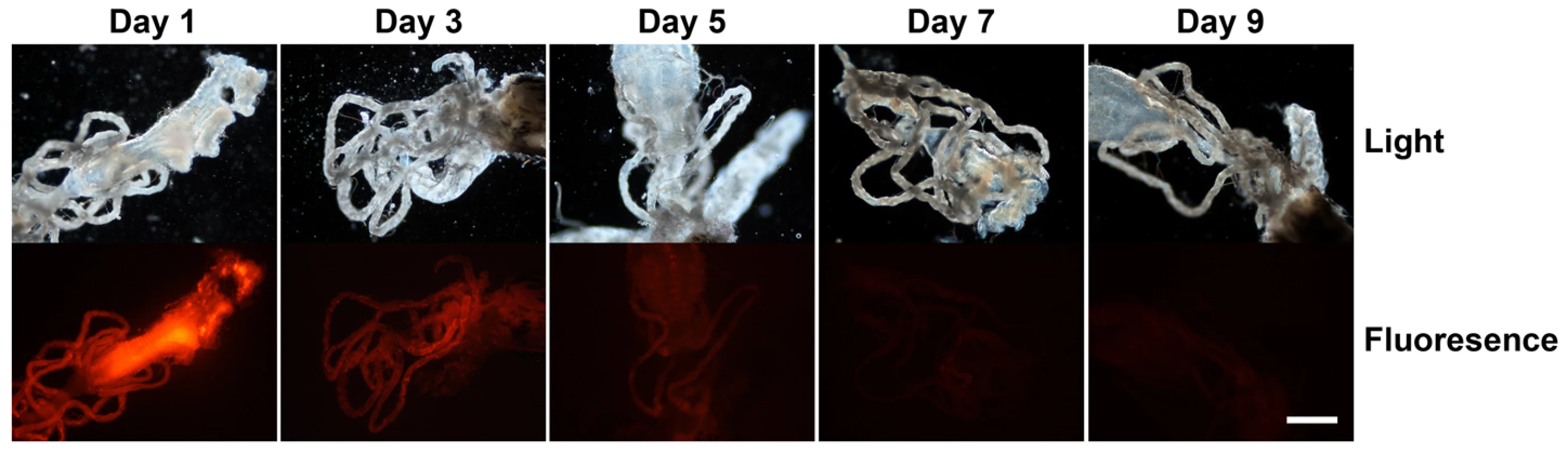 Dissemination and persistence of intrathoracically injected Cy 3-labelled <i>Brugia malayi</i> Cathepsin-L1 siRNAs in <i>Aedes aegypti</i>.