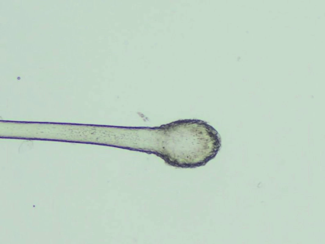 Kyjovitý bulbus telogenního vlasu ve světelném mikroskopu (zvětšení 40krát)