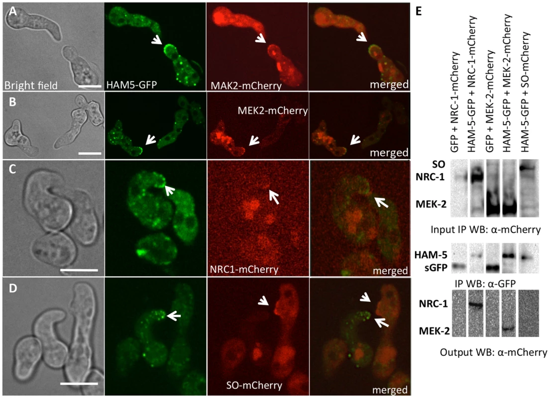 HAM-5-GFP shows localization with components of the MAK-2 pathway.
