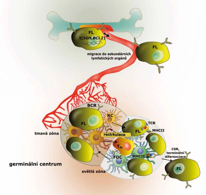 Schematická ilustrace vývoje maligní FL buňky.
Po translokaci t(14,18) migrují premaligní B lymfocyty do sekundárních lymfatických orgánů, kde mohou akumulovat další mutace, a stát se tak maligními buňkami odpovědnými za vznik FL.
FL – folikulární lymfom, &lt;i&gt;BCL2&lt;/i&gt; – B-cell lymphoma 2, BCR – B buněčný receptor, CSR – izotypový přesmyk, FDC – folikulárně dendritická buňka, &lt;i&gt;IGH&lt;/i&gt; – gen pro těžký řetězec imunoglobulinu, MHCII – hlavní histokompatibilitní komplex II, RC – retikulární buňka, TCR – T buněčný receptor, T&lt;sub&gt;fh&lt;/sub&gt; – pomocné folikulární T lymfocyty