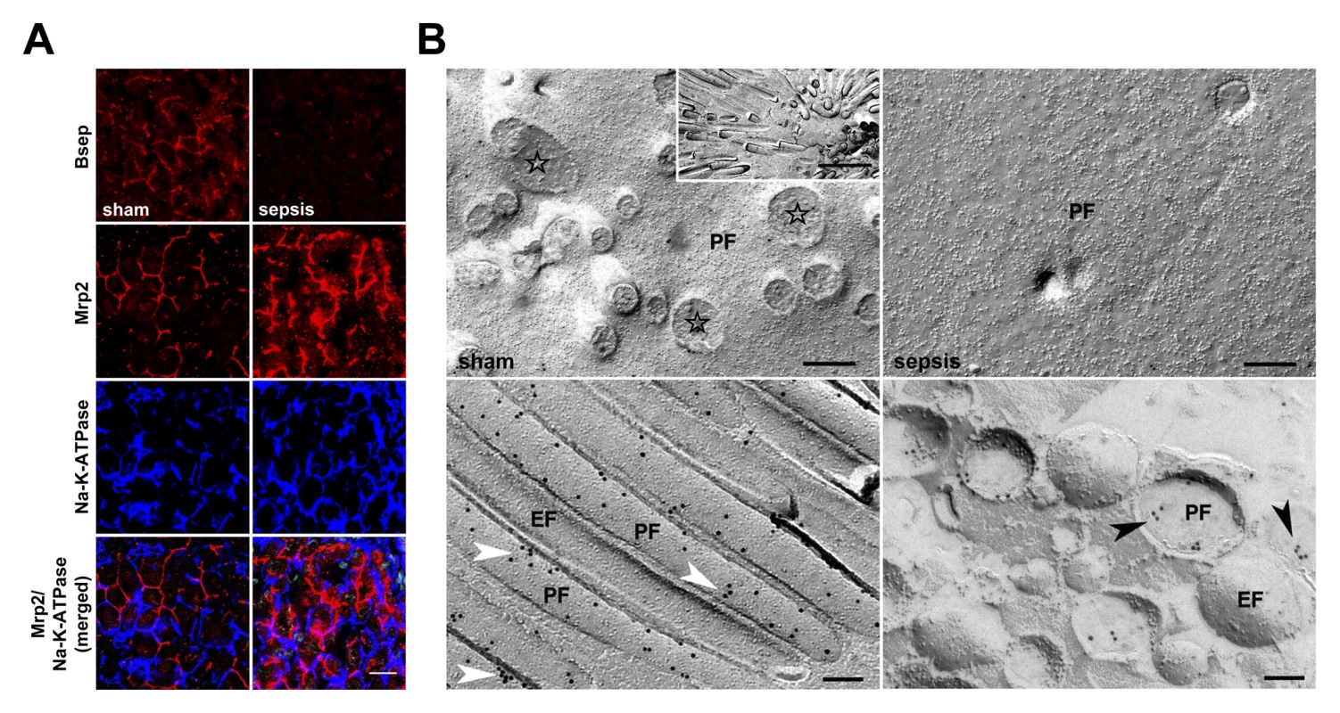 Altered expression of canalicular bile acid and organic anion transporters in sepsis.