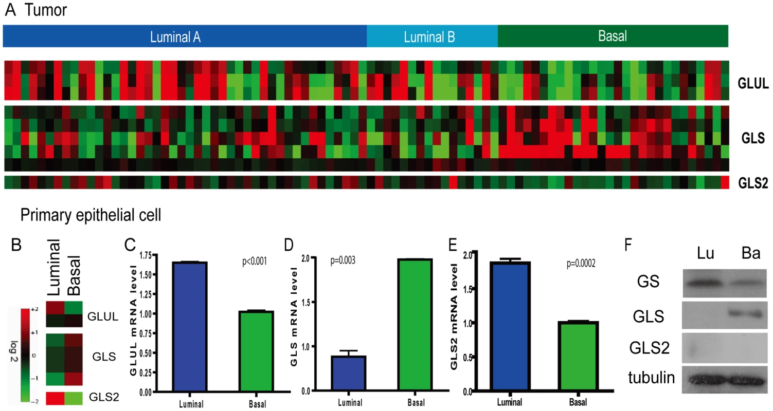 Persistent differential expression of genes encoding glutamine-metabolizing enzymes in the basal and luminal breast tumors and primary epithelial cells.