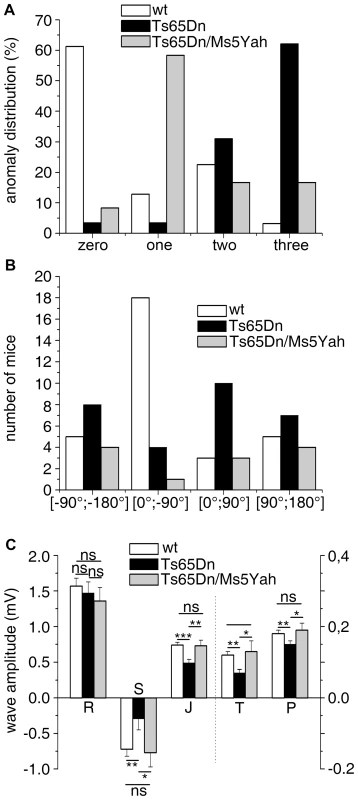 Partial rescue of ECG features in Ts65Dn/Ms5Yah compound mice.