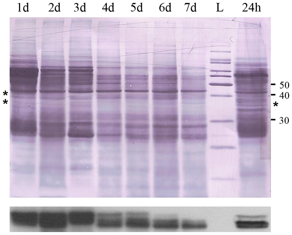 Immunoblot film lies below the nigrosine-stained PVDF.