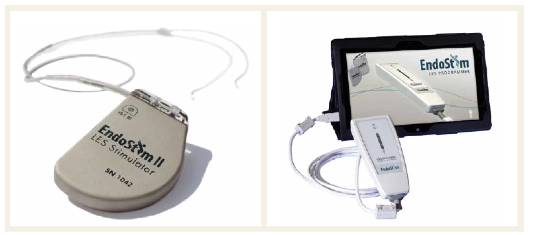 EndoStim – programovatelný implantabilní pulzní generátor, bipolární stimulační elektrody a externí bezdrátový programátor.
Fig. 1. EndoStim – a programmable implantable pulse generator, a bipolar stimulation lead with two stitch electrodes, and an external wireless programmer.