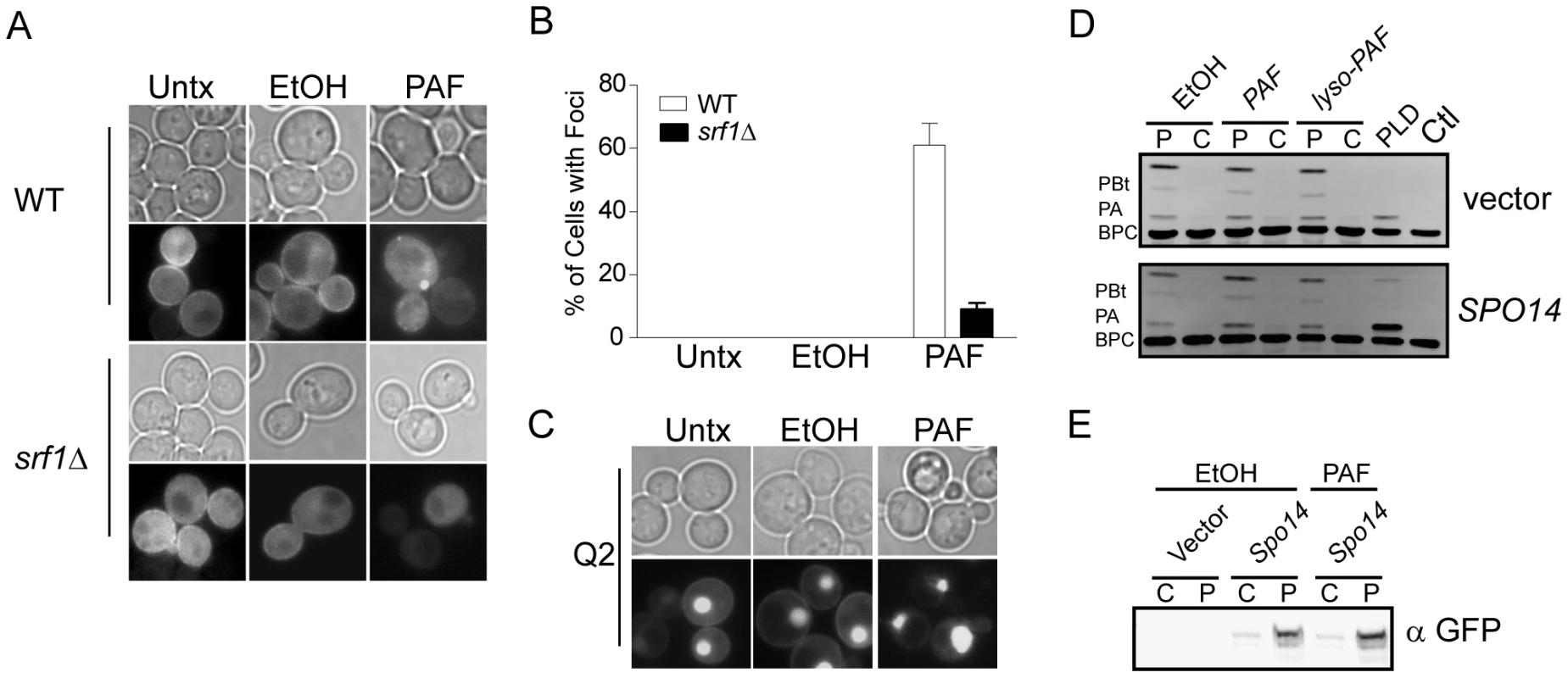 C16:0 PAF treatment impacts the subcellular localization of PLD but not its catalytic activity.