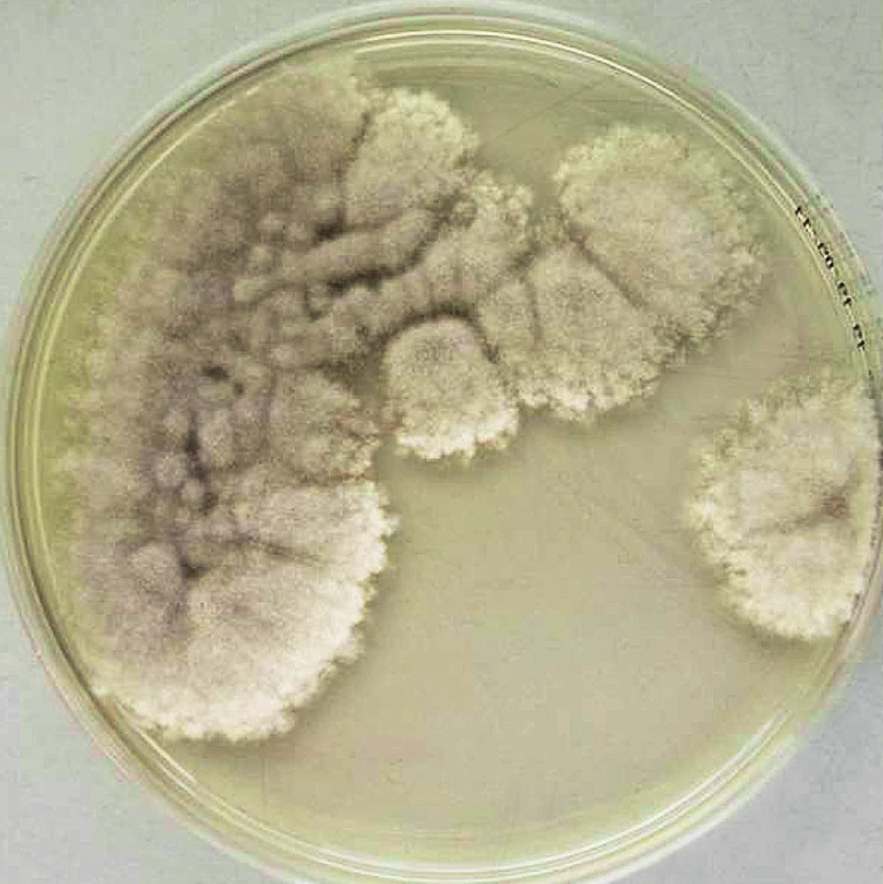 Kolonie izolátu &lt;em&gt;Scedosporium apiospermum&lt;/em&gt; na Sabouraudově agaru (7 dnů, 37 °C) od našeho pacienta.