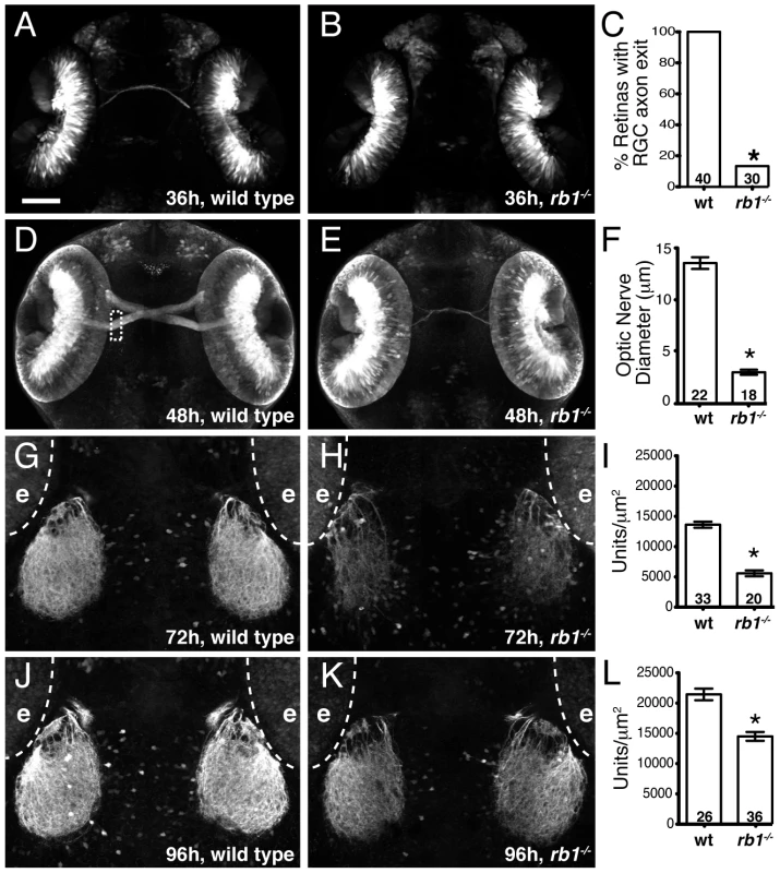 Rb1-deficient embryos possess delayed retinotectal projection.
