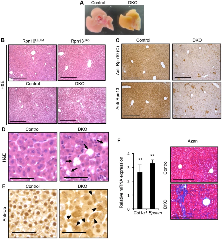 Simultaneous deletion of Rpn10-UIM and Rpn13 causes severe liver injury.