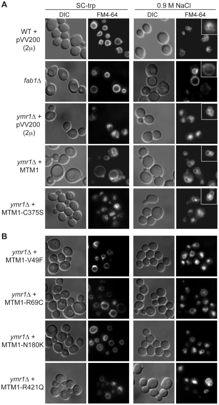 Yeast vacuolar phenotype analysis upon MTM1 expression.
