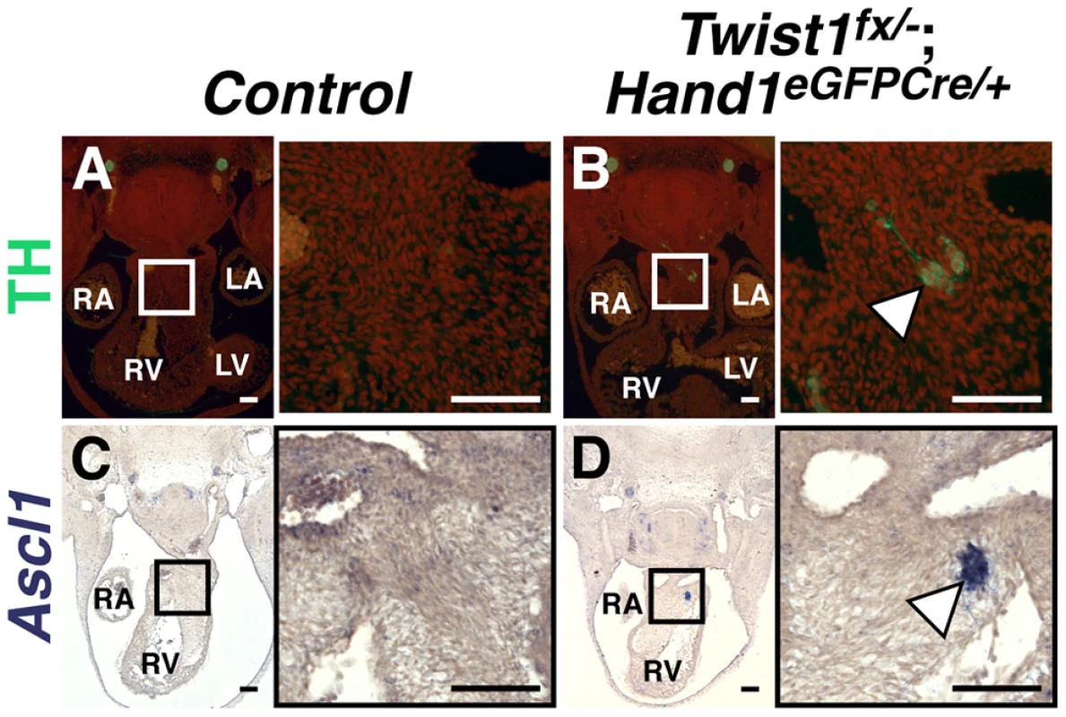 Ectopic sympathetic-like neurons are detectable in <i>Twist1</i>;<i>Hand1<sup>eGFPCre</sup></i> CKO APCs.
