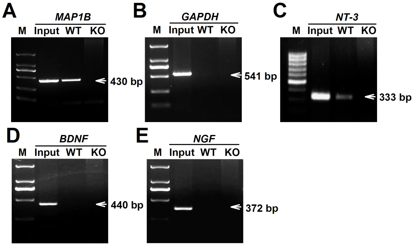 FMRP interacted directly with <i>NT-3</i> mRNA.