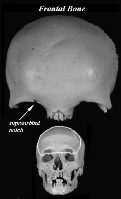Horná tretina tvárovej kostry a supraorbitálna oblasť. http://www.med.mun.ca/anatomyts/head/hnl1.htm