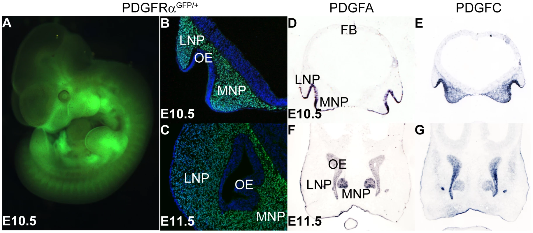 PDGFRα and its ligands PDGFA and PDGFC are expressed during midface development.