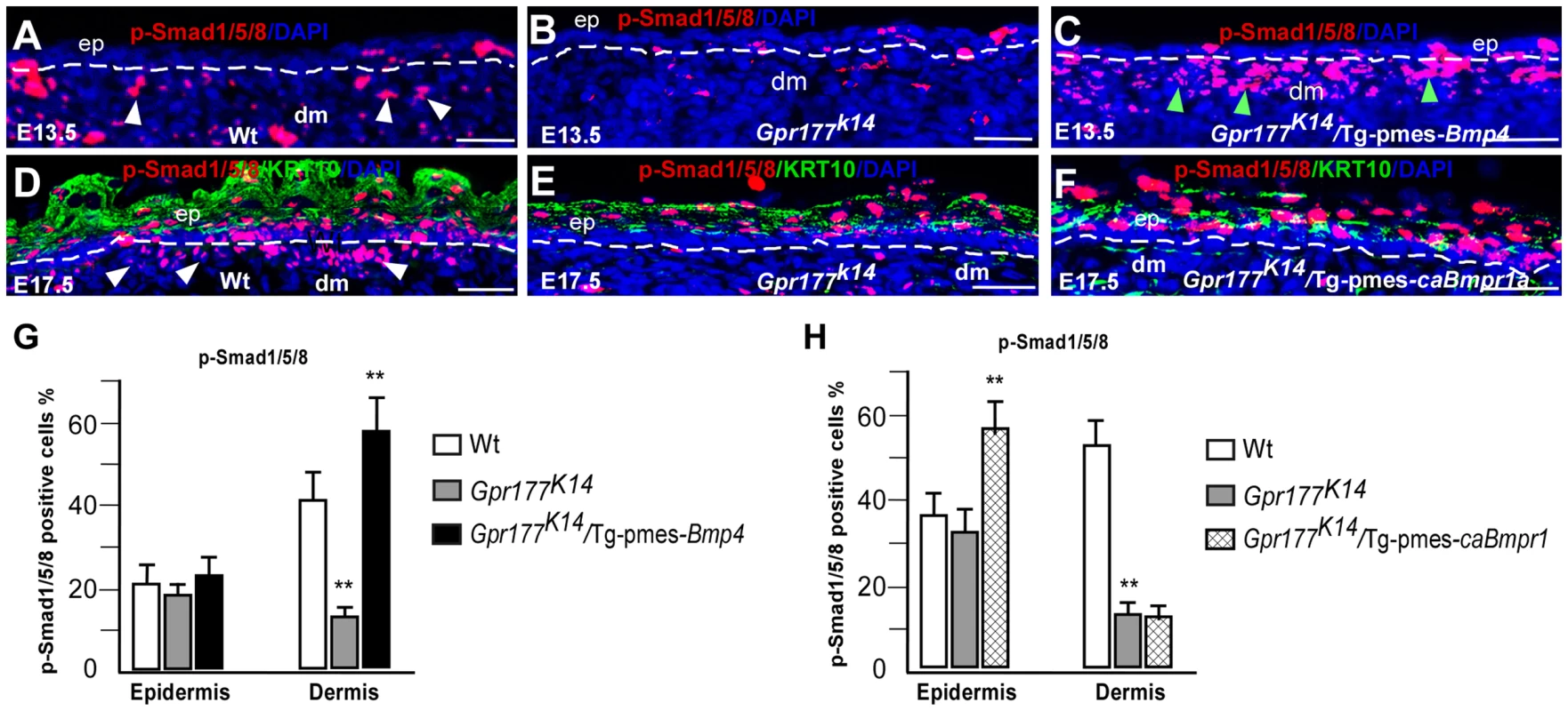 Transgenic pmes-<i>Bmp4</i> reactivates Smad1/5/8 signaling in the dermal mesenchyme in <i>Gpr177<sup>K14</sup></i>/Tg-pmes-<i>Bmp4</i>.