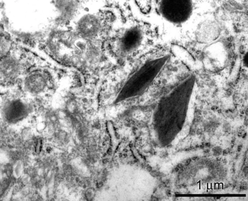 Romboidní granula opouzdřená membránou v cytoplazmě, elektronová mikroskopie, 40 000krát