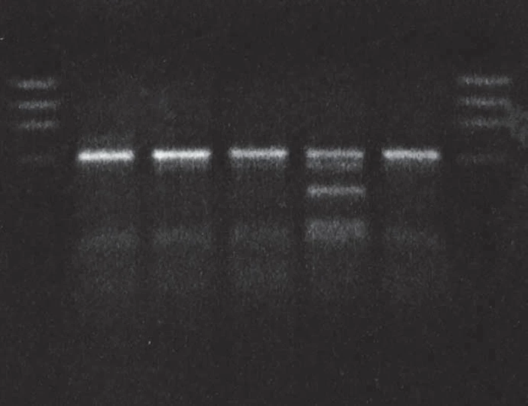 MaeII restricton of PCR product: proband in gCJD<sup>E200K</sup> affected family.