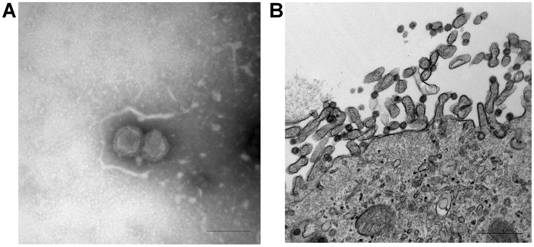 Ultrastructural analysis of C/OK virus isolate in cell culture as observed by negative stain (A) and thin-section (B) electron microscopy.