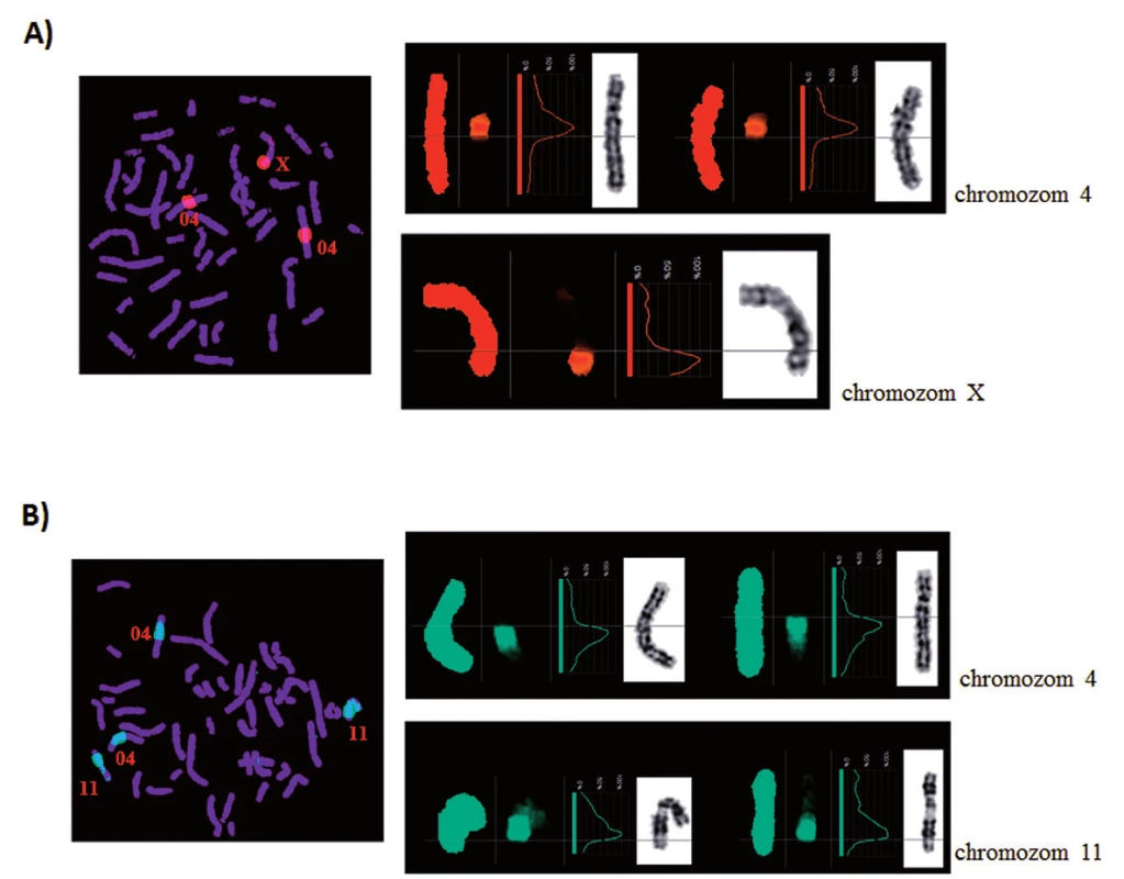 Reverzní FISH. Ověření specifity disekovaných chromozomových fragmentů u pacienta 2. A) Derivovaný chromozom 4. B) Derivovaný chromozom 11.