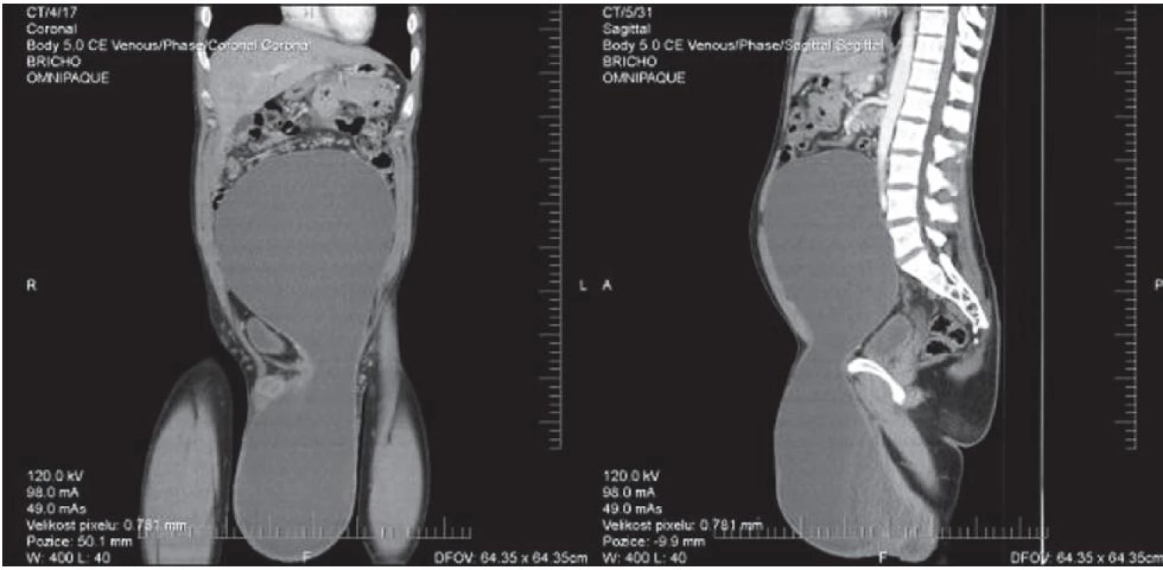 CT snímky před operací
Obr. 2. CT images before the operation
