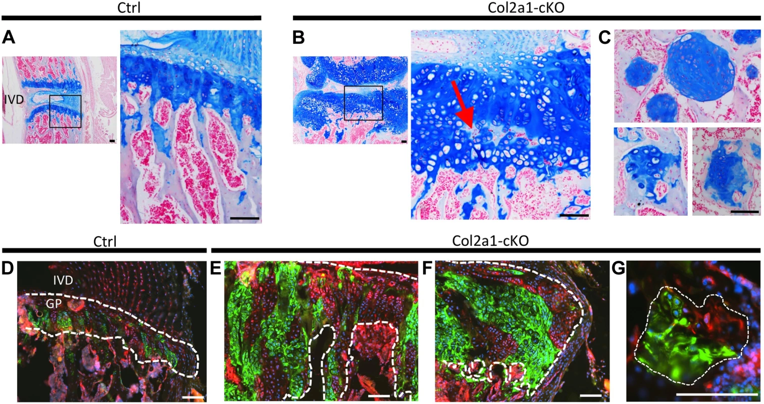 Lineage tracing of SHP2-depleted chondrocytes in mouse vertebral growth plates following mosaic postnatal <i>Ptpn11</i> inactivation.