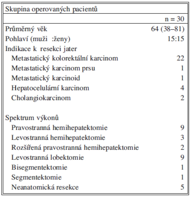 Přehled spektra indikací a výkonů u skupiny laparoskopických resekcí jater pro maligní onemocnění na chirurgické klinice FN Hradec Králové.