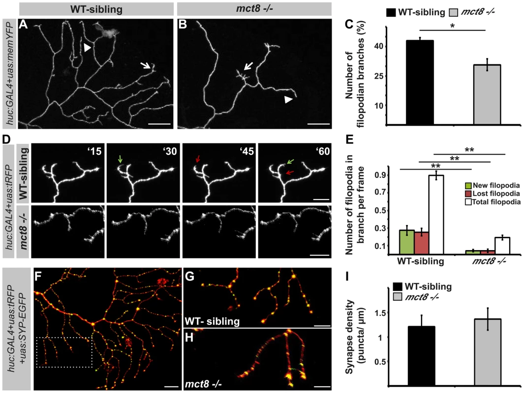 MCT8 reduces filopodia dynamics in the axons of RB neurons.