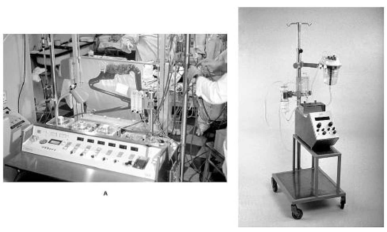 A – moderní přístroj pro mimotělní oběh Sarns 5000, B – miniaturní přístroj pro mimotělní oběh pro novorozence a kojence vlastní konstrukce